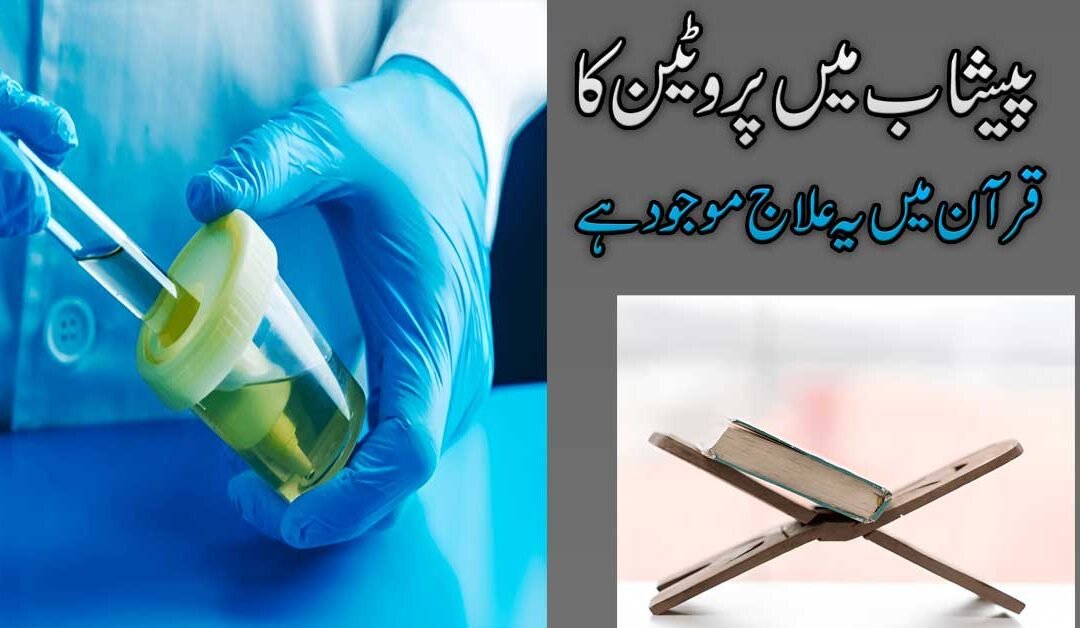 Protein In Urine (Proteinuria) Symptoms