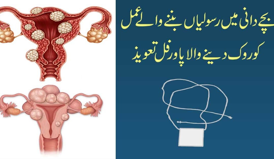 Fibroid Se Shifa Ka Powerful Taweez