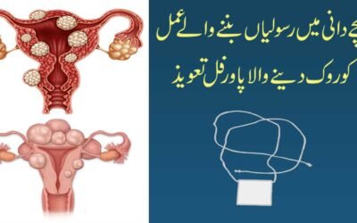 Fibroid Se Shifa Ka Powerful Taweez