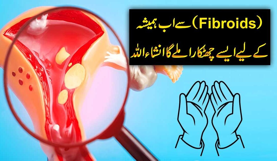 Fibroid Se Shifa Ka Rohani Taweez