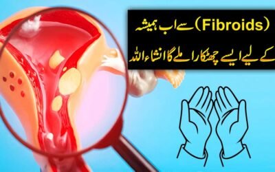 Fibroid Se Shifa Ka Rohani Taweez