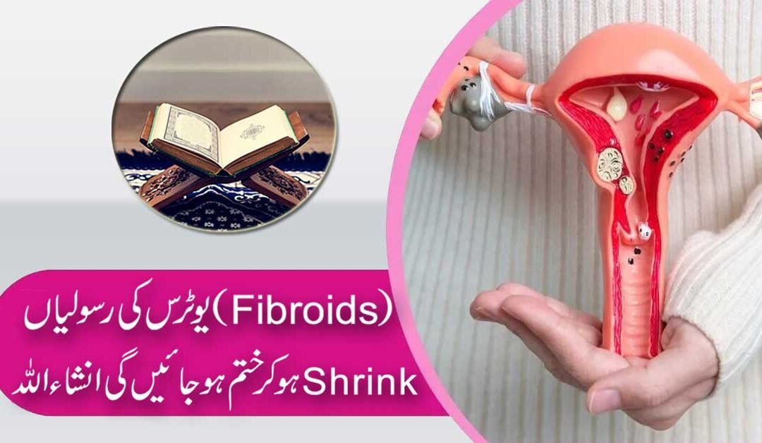 Fibroids Ka Jarr Se Khatma Taweez Se