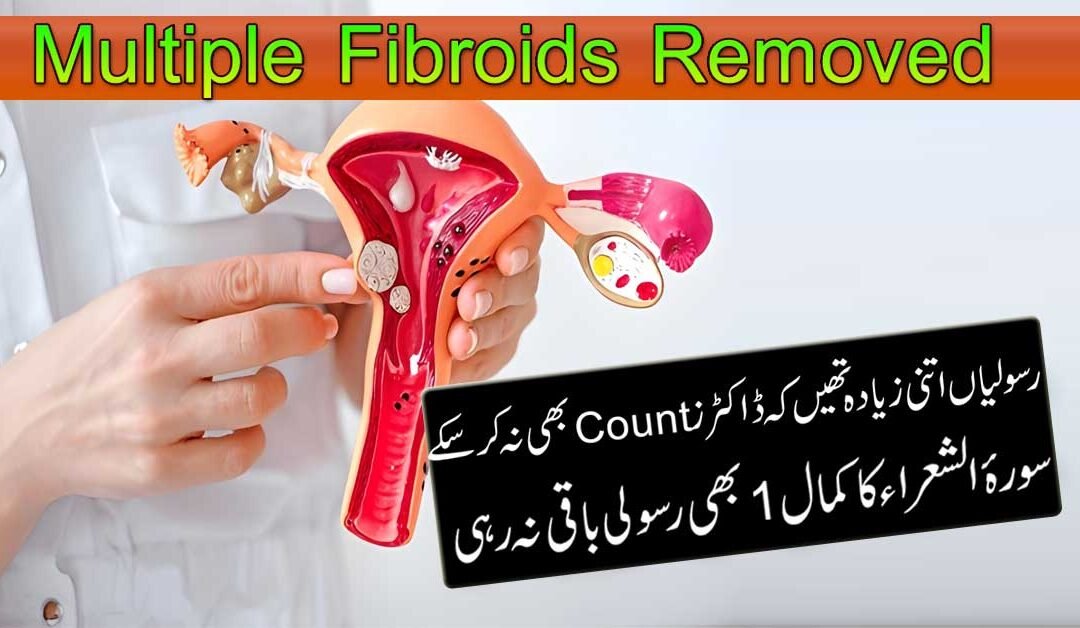 Bachaydani Ki Rasolian Se Shifa Ka Naqsh