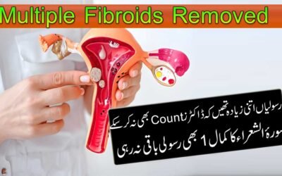 Bachaydani Ki Rasolian Se Shifa Ka Naqsh