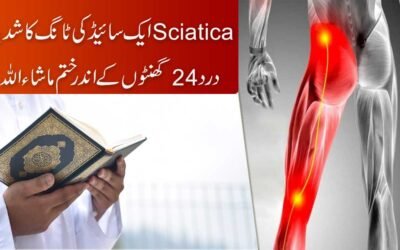 Miracle Surah For Sciatica Pain