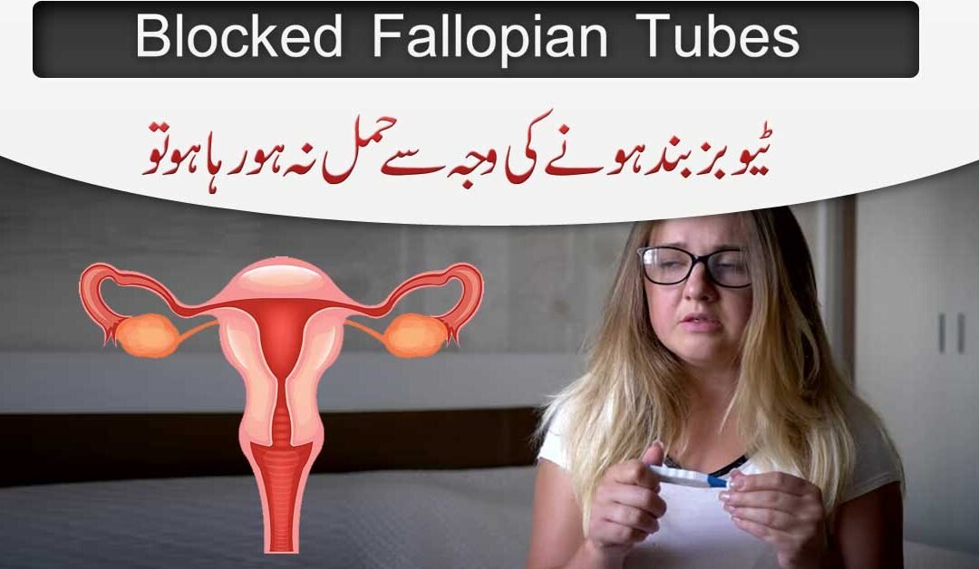 Tubes Band Hain Hamal Nahi Ho Raha