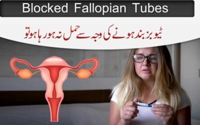 Band Tubes Ko Kholne Ka Ilaj